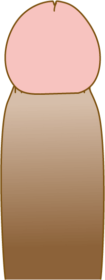 包茎手術の料金トラブル　パート1