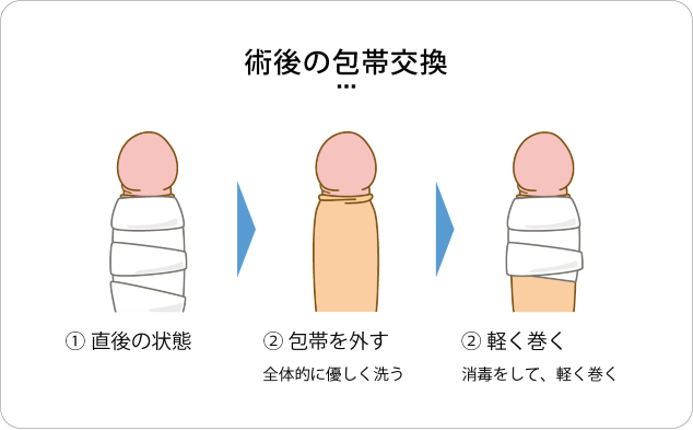 術後の包帯交換