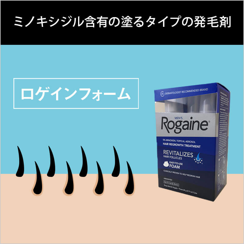 ロゲインフォーム